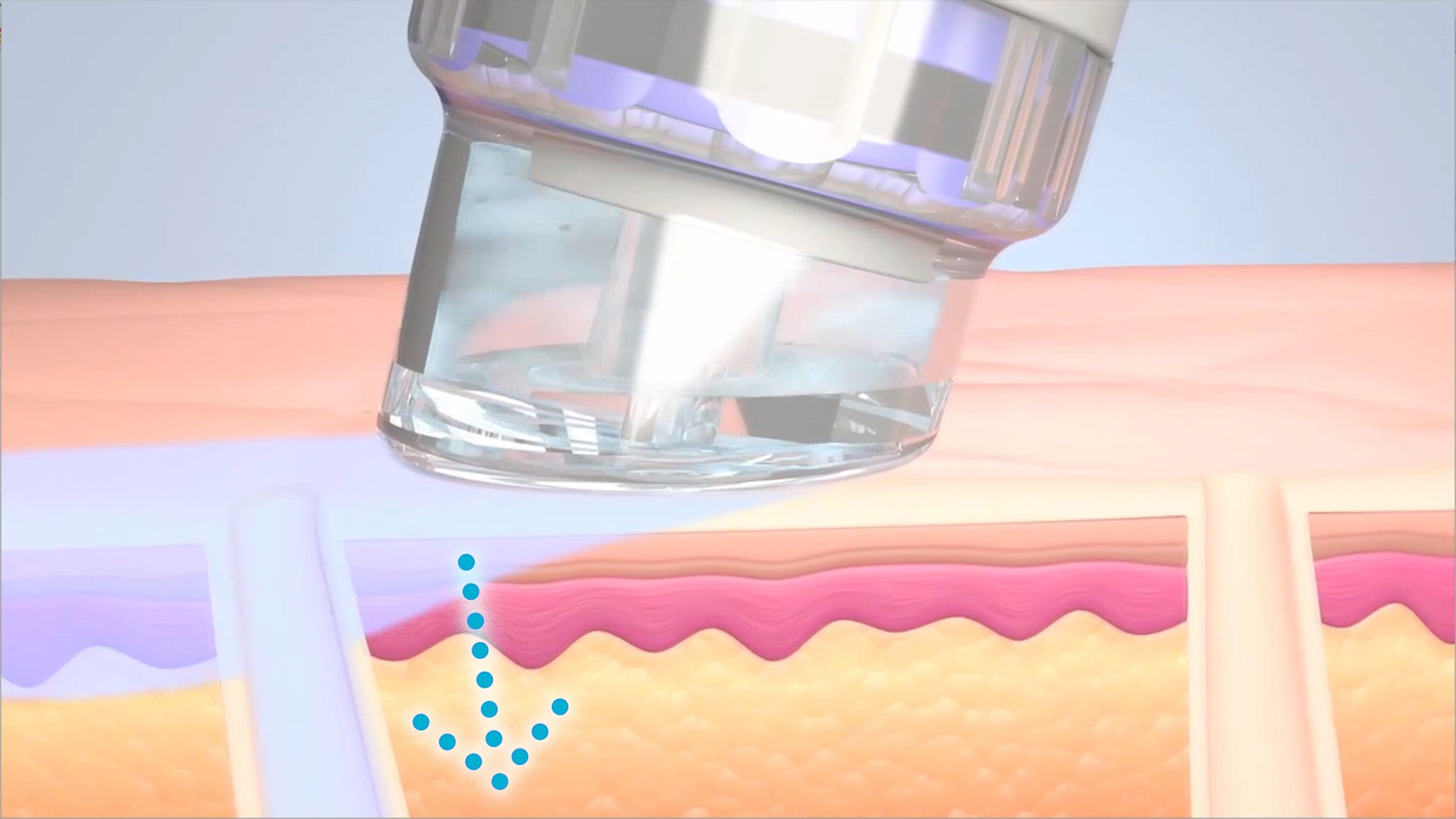 Hydrafacial Berlin Schmargendorf step 4